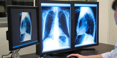 Pulmonology is a medical specialty that deals with respiratory diseases.